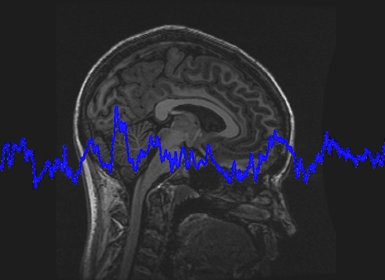 DR. SWINGLE'S SEIZURE DISORDERS WEBINAR RECORDING